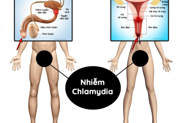 Chlamydia là bệnh gì? Nguyên nhân, triệu chứng, cách phòng tránh